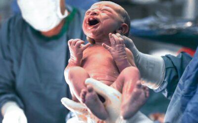 Reanimación neonatal y la importancia del neonatólogo en la toma de desiciones