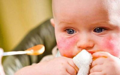 Alergia alimentaria en la infancia: qué la favorece, qué consecuencias deja y qué podemos hacer.